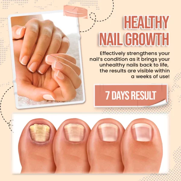 Zakdavi™️ 7 Days Nail Growth and Strengthening Serum - Image 4