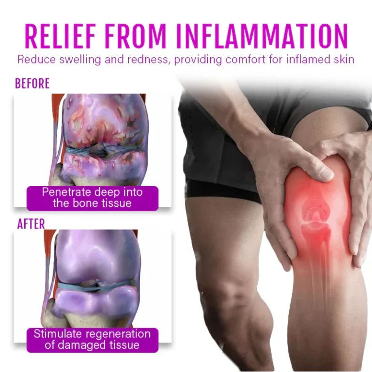 Biancat™ ComfreyRelief Organic Herbal Salve 4Oz - Image 7