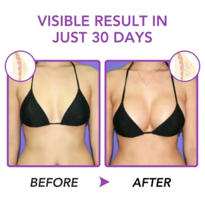 Fivfivgo™ Bee Pollen Firming Capsule - Image 4