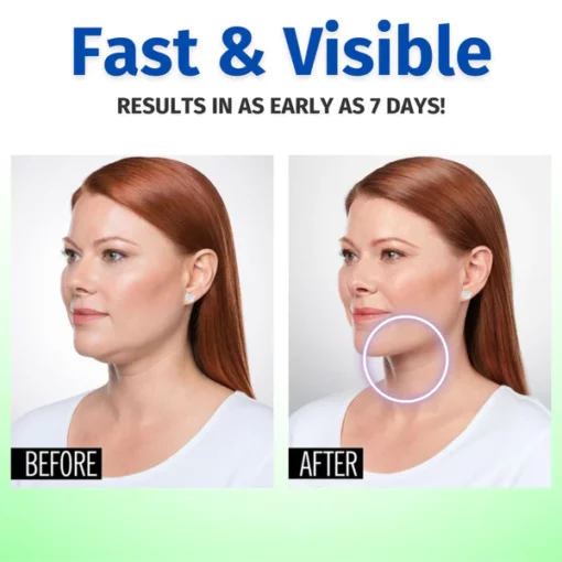 VITAURA™ Lymphatic Drainage Slimming Earrings - Image 8