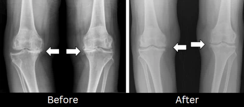 Oveallgo™ JointCare Pain Relief Spray - Image 4