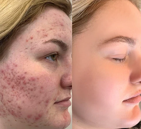 Ceoerty™ PureRich Cleansing Foam Oligopeptide Serum - Image 4