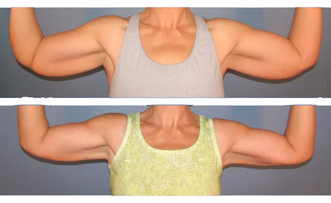 FitMax™ Arm Enhancer Sleeves - Image 3