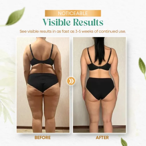 Zakdavi™️ CollagenPlus Lifting Body Oil - Image 5