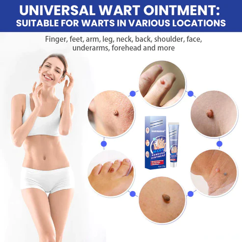 DermaEnd™ Wart Remover Herbal Ointment 100% Natural - Image 4