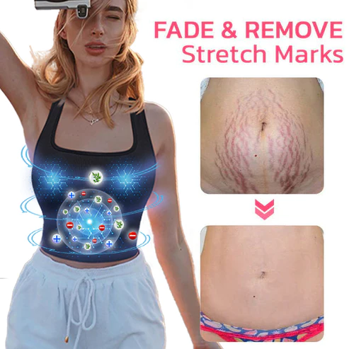 2023 EXPECTSKY™ Ion Vest Shapewear