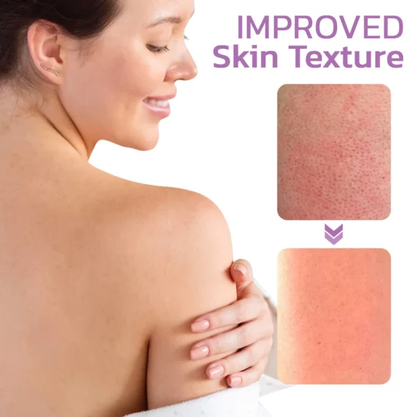 flysmus™ KP Keratosis Balance Eraser Body Scrub - Image 7