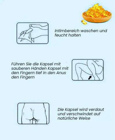 Oveallgo™ Natürliche PURI Kräuterstarke Hämorrhoiden-Kapseln - Image 5