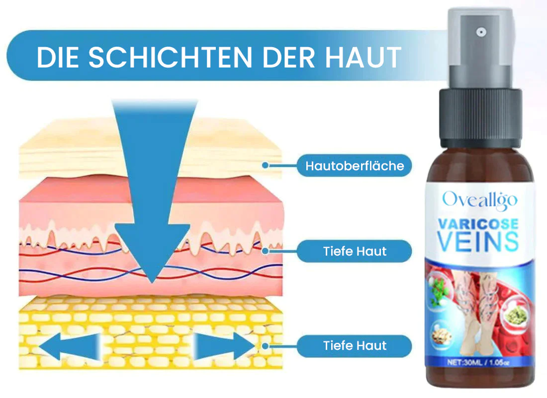 Oveallgo™ VenenErleichtern Varikosener Spray - Image 10