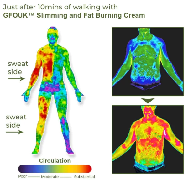 GFOUK™ Slimming and Fat Burning Cream - Image 6