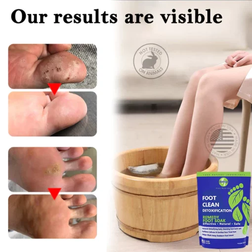 Oveallgo™ Herbal Detox Cleansing Foot Care Pack - Image 6