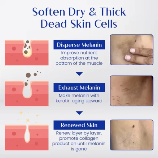 Ceoerty™ White Radiance Body Exfoliating Gel - Image 8