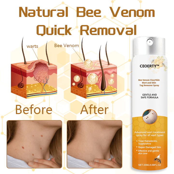 Ceoerty™ Bee Venom ClearSkin Wart and Skin Tag Remover Spray - Image 5