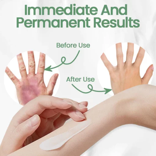 Ceoerty™ Peony Anti Eczema Cream - Image 4