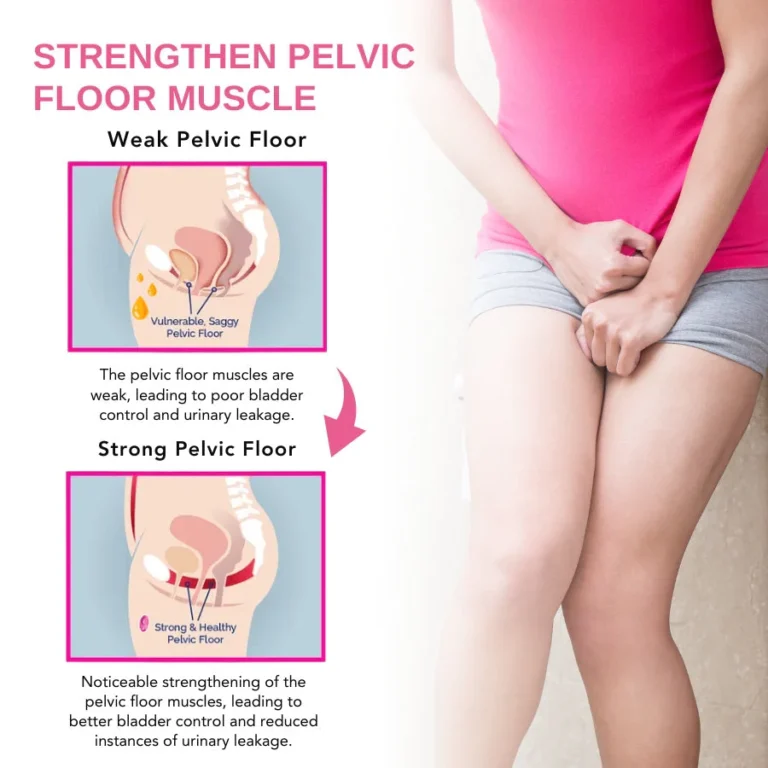 Oveallgo™ Urinary Anti-Leakage Capsules - Image 4