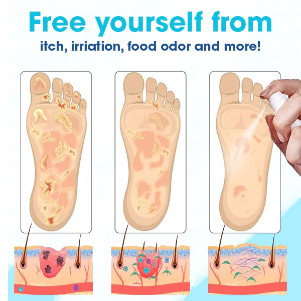 Medix™ Athlete’s Foot & Fungus Spray - Image 6