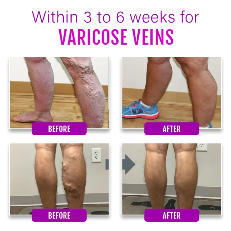 Biancat™ ComfreyRelief Organic Herbal Salve 4Oz - Image 5