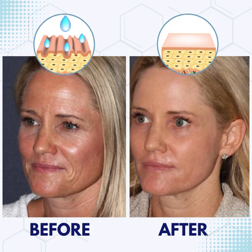 BeYouth™ Pro-Collagen Ampoule - Image 6