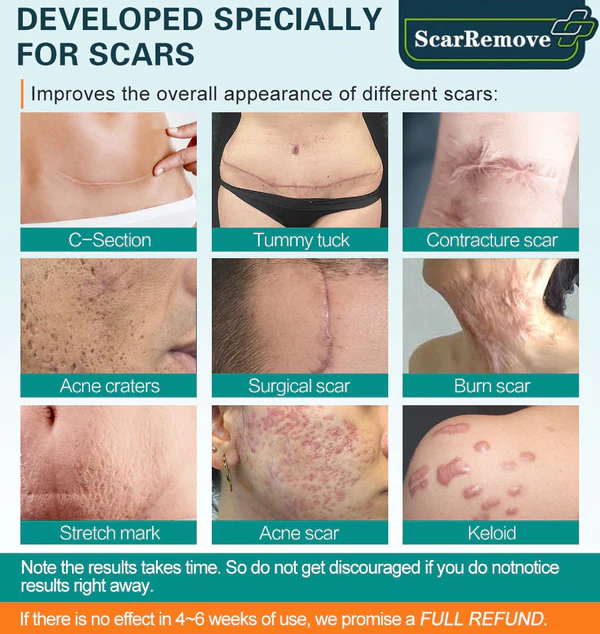 Advanced Scar Spray For All Types of Scars - Image 5