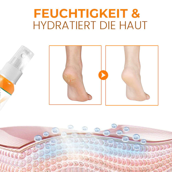 Oveallgo™ PediSoft PURI Fuß Hornhautentfernungs-Spray - Image 8