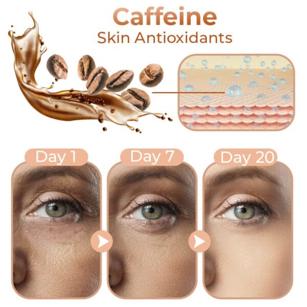 GFOUK™ Milk Spots Removal Eye Cream - Image 4