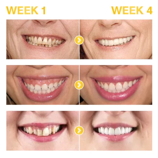 Liacsy™ 7 Days ProActive Gum Treatment - Image 6