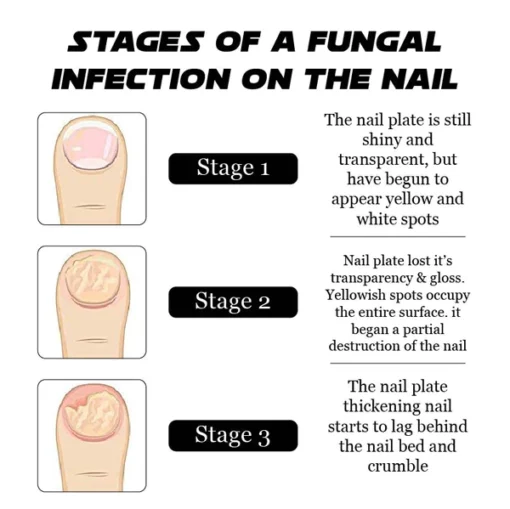 ATTDX FootHealing EssentialOil BathTablets - Image 4
