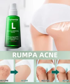 LightenUp™ Buttocks Acne Erasing Serum