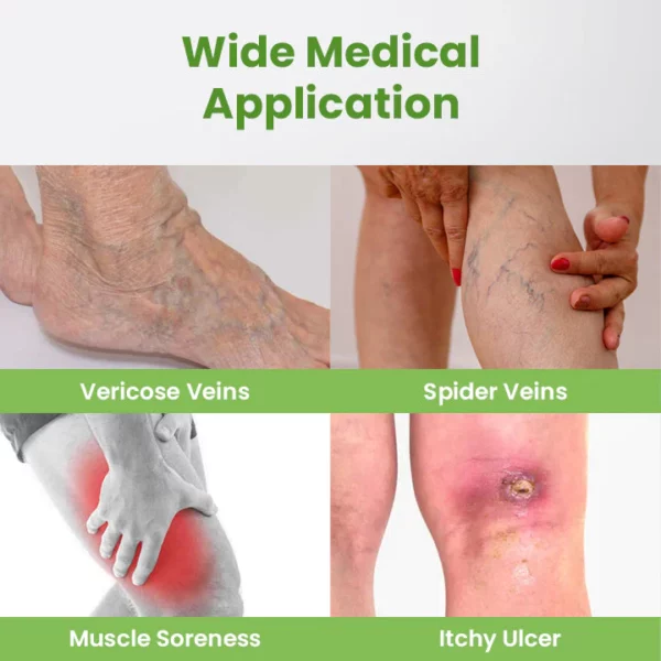 Ceoerty™ Varicose Vein PRO Xpert Spray - Image 4