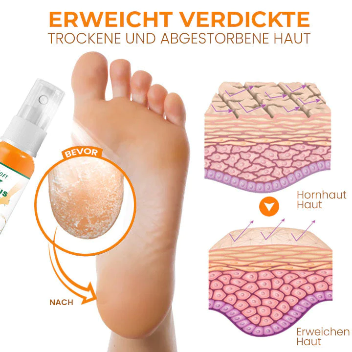 Oveallgo™ PediSoft PURI Fuß Hornhautentfernungs-Spray - Image 7