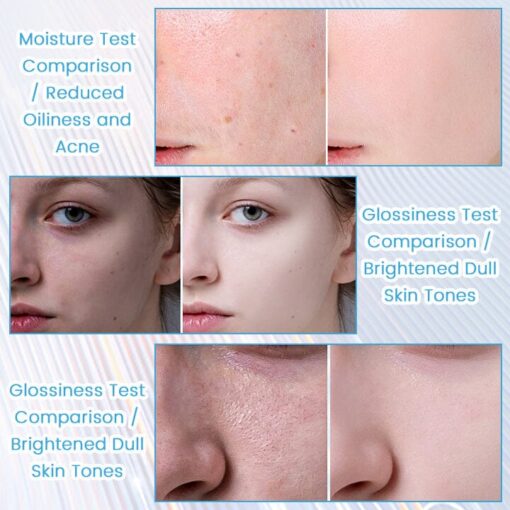 Fivfivgo™ ClariSkin 2% Salicylsäure Ausgleichendes Reparaturserum - Image 5