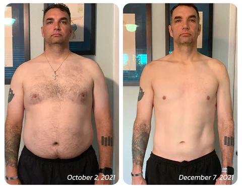 ANWX GFOUK™ Blue Carbon TitanBracelet - Image 3