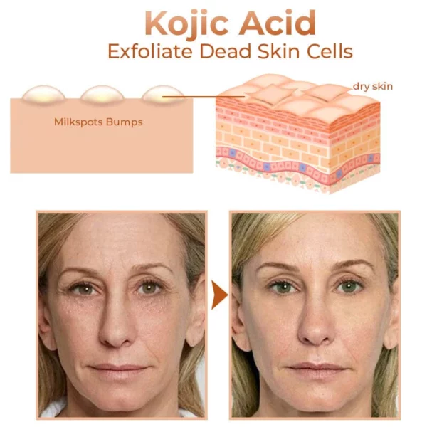 GFOUK™ Milk Spots Removal Eye Cream - Image 3