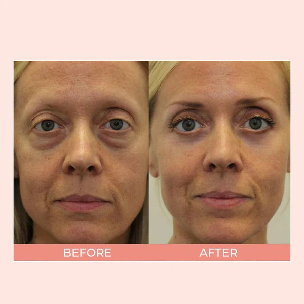 EIASER Retinol Polypeptide Repair Eye Cream - Image 5