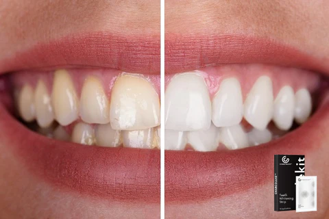 CHARCOLUXE™ Teeth Whitening Strip - Image 5