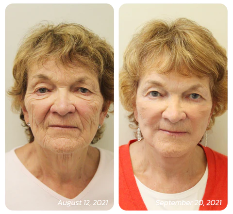 Humxf™ Snail Mucin Multi-Peptide Advanced Repair Cream - Image 6