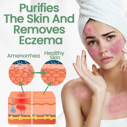 Ceoerty™ Peony Anti Eczema Cream - Image 6