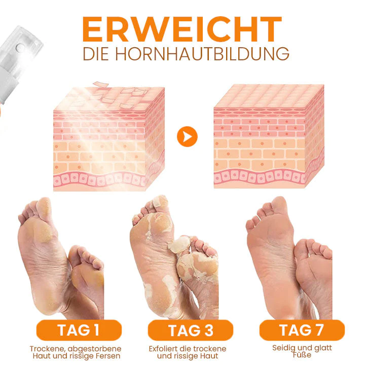 Oveallgo™ PediSoft PURI Fuß Hornhautentfernungs-Spray - Image 5