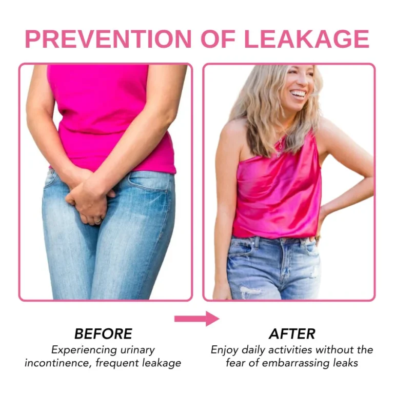 Oveallgo™ Urinary Anti-Leakage Capsules - Image 6