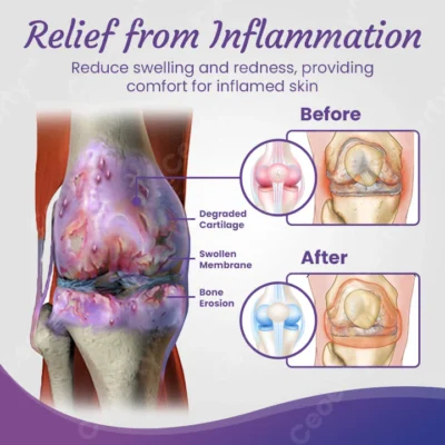 Ceoerty™ JointCure Organic Comfrey Salve - Image 5