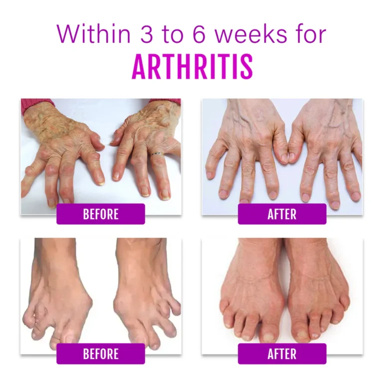 Biancat™ ComfreyRelief Organic Herbal Salve 4Oz - Image 8