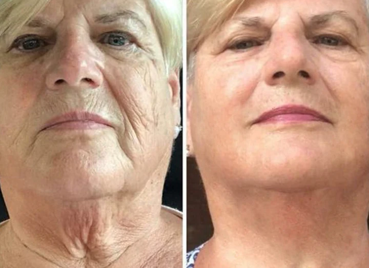 LIMETOW™ SwanPro Hydrolyzed Collagen Neck Cream - Image 7