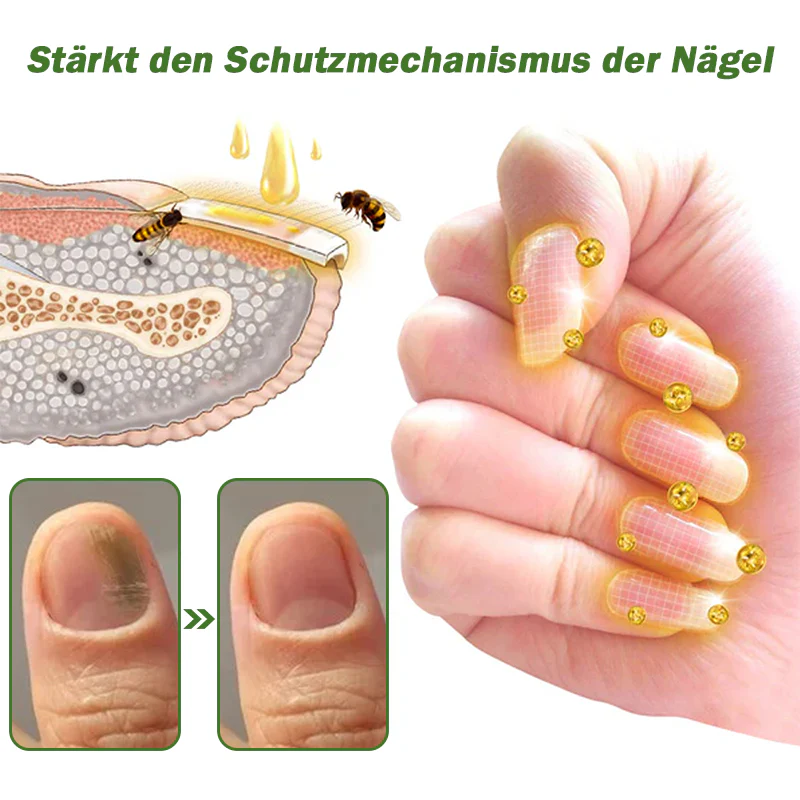 Furzero™ Nagelverteidigung Bienengift-Behandlungsserum pro - Image 12