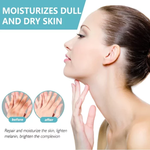 Glow™ EELHOE-Acanthosis Nigricans Therapy Cream - Image 5