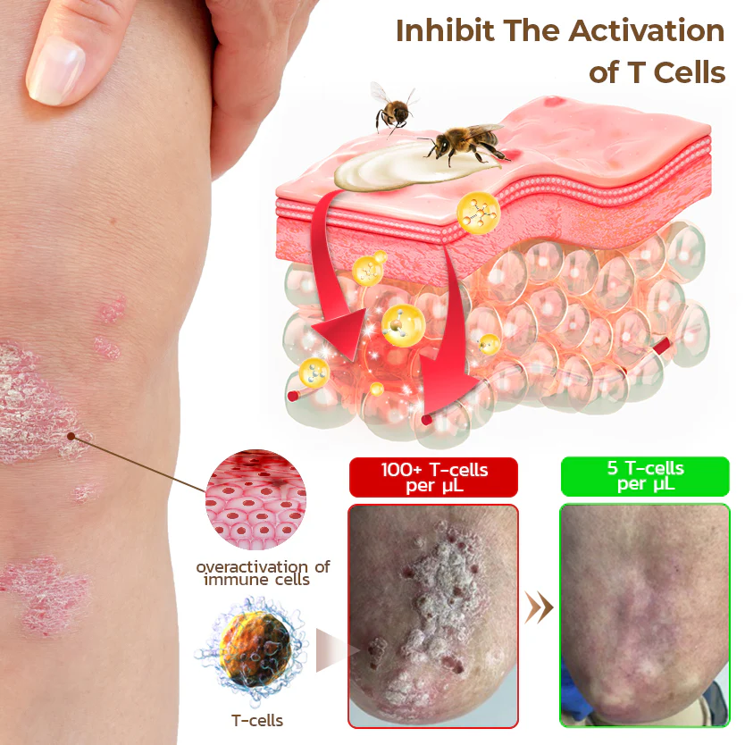 PsoriX Bee Venom Cream - Image 6