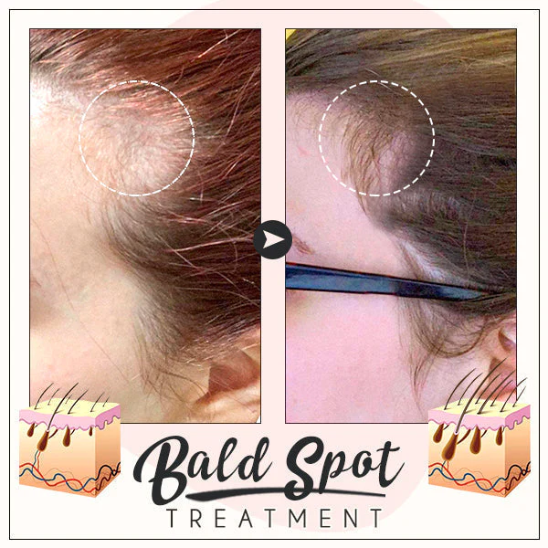 EELHOE™ Hair Boost Ginger Cream - Image 6