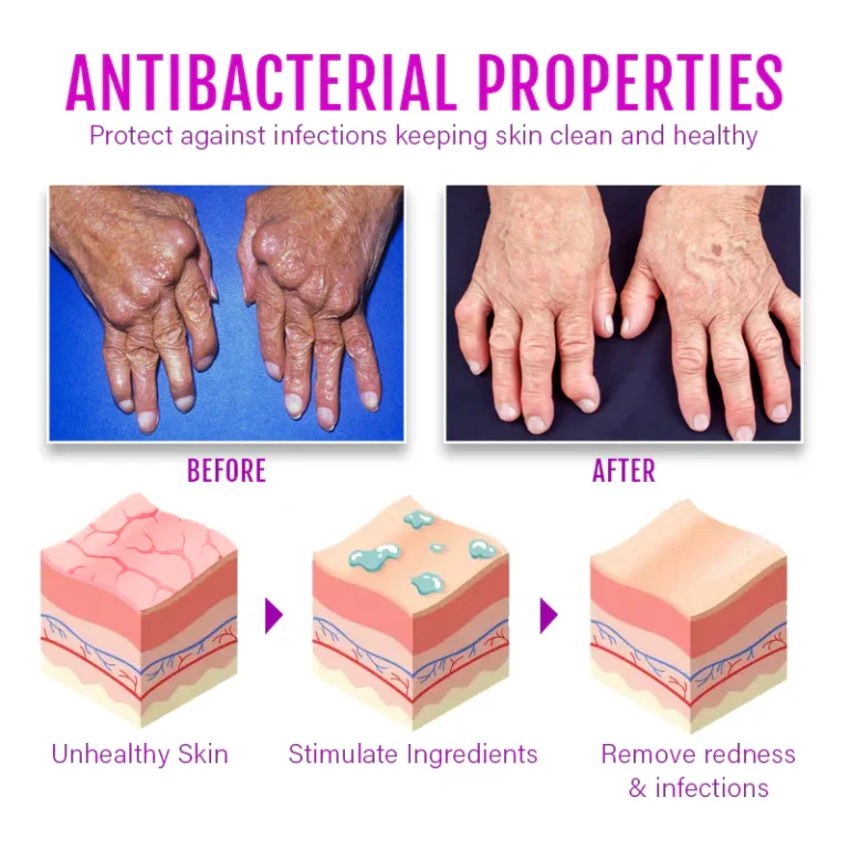 Biancat™ ComfreyRelief Organic Herbal Salve 4Oz - Image 6