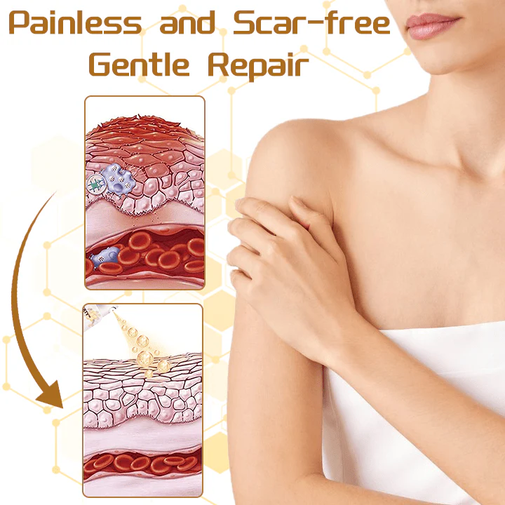 Ceoerty™ Bee Venom ClearSkin Wart and Skin Tag Remover Spray - Image 3