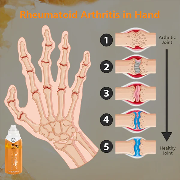 Oveallgo™ Apitherapy Joint Mobility Aid Spray - Image 4