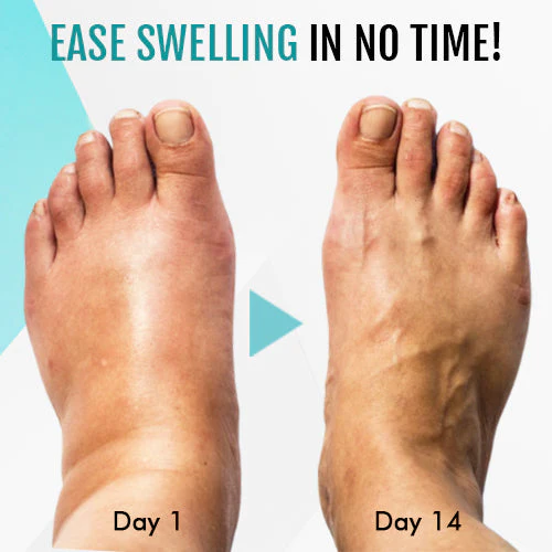 Zunis™ Thermotherapy Detox Anklet - Image 6